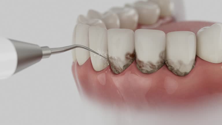 Reliable Dental contractor in Big Bear Lake, CA by Dentist Open Now